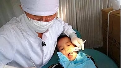 اكتشاف مفاجئ وراء رائحة فم طفل.. طبيب يستخرج حصوات من لوزتيه