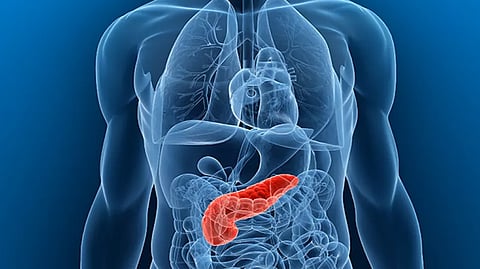 علماء يحددون ميكروبات فموية تزيد خطر الإصابة بسرطان البنكرياس ثلاث مرات