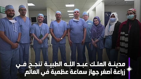إنجاز طبي غير مسبوق في المملكة والشرق الأوسط: زراعة أصغر سماعة عظمية لعشرينية بمكة