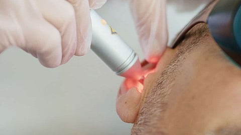 "النمر" يحذّر من "علاج الليزر للإقلاع عن التدخين": غير مثبت علميًّا ويُسوّق بأسعار مبالغ فيها