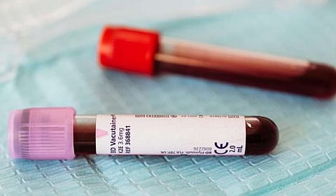 دراسة دولية: اختلاف نتائج اختبارات وظائف الكلى يُنذر بمخاطر صحية