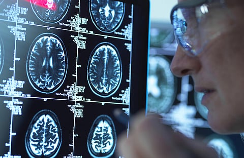 آلية جديدة باستخدام NAD⁺ تُنعش آمال علاج ألزهايمر