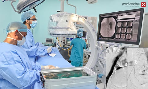 مستشفى الدكتور سليمان الحبيب بالقصيم يعالج جلطات وانسدادات ضخمة في الوريد الفخذي بالأشعة التداخلية 