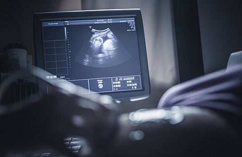 ليست مشاكل الكروموسومات فقط.. دراسة جديدة: تقدم عمر المرأة قد يكون السبب الحقيقي وراء فشل الحمل