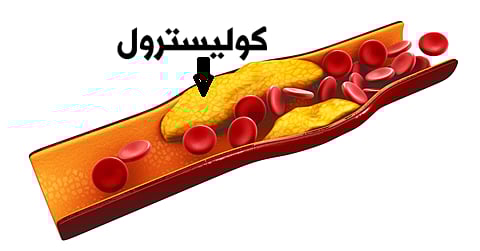 ارتفاع الكوليسترول السيء.. أعراض على الساقين تحذر من مخاطر قلبية