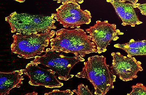 دراسة تايوانية تفتح أفقًا جديدًا لعلاج سرطان الكبد. تعطيل جين RUNX2 يستعيد نشاط الخلايا المناعية المُنهكة. تجاوز مقاومة العلاج المناعي وإيقاف نمو الأورام. يمهّد لعلاجات مركبة ومؤشرات حيوية أدق للمرضى 