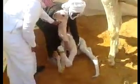 بالفيديو.. "بكرة" متشابهة السيقان