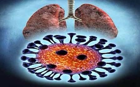 استشاري عناية لـ"سبق": متابعة الممارسين بالمستشفيات تُحِدُّ من كورونا