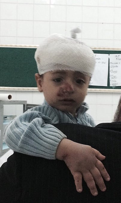 العثور على مفقود كلاخ الطفل "إياد" مُصاباً برأسه داخل مسجد بالطائف