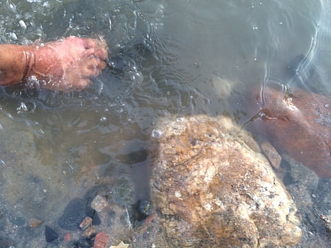 بالصور.. عين حارة بوادي "ذِبَح" تعالج البواسير والأمراض الجلدية