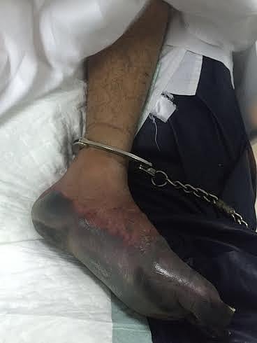 "الصحة" عن السجين المنوم بمستشفى صبيا: تدهور حالته استدعت تنويمه حال وصوله