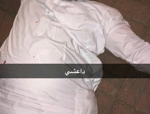 "سبق" تكشف تفاصيل تعرض مواطن للاعتداء واتهامه بالانتماء لـ"داعش" بالقطيف