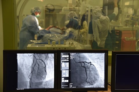 نجاح أول عملية "قسطرة للقلب" بالجوف