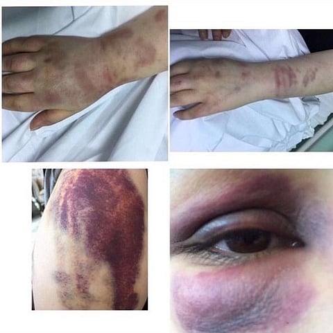 مصدر لـ"سبق": "الاجتماعية" لا تتدخل بمصير زوج "معنفة سكاكا"