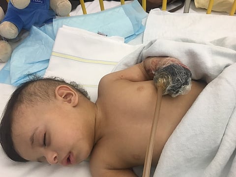 الأطباء الألمان يقررون زراعة اليد المعطوبة لجسار أسفل معدته