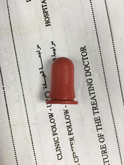 مركز صحي "زيماء مكة" ينقذ طفلة ابتلعت "سدادة"