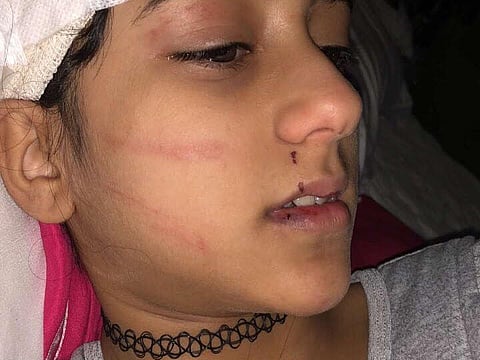 مايا بخش طفلة السوشيال ميديا تنجو من نمر في مزرعة شمال جدة