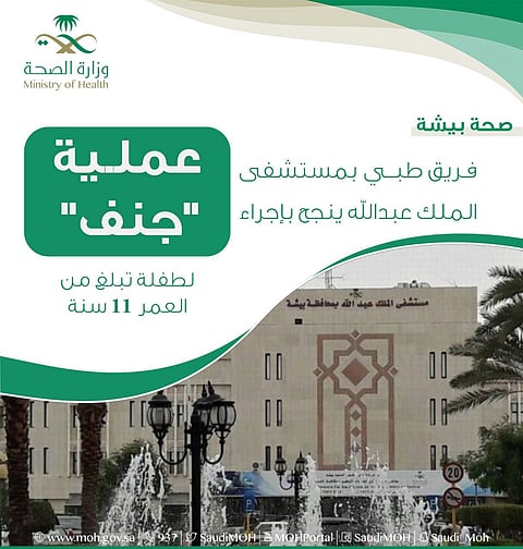 بيشة.. "عملية الـ 7 ساعات" تصلح "جنف" طفلة وتثبت فقرات ظهرها