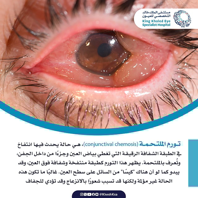 ���� �������� ���� ����� ���� sabq/2025-01-26/