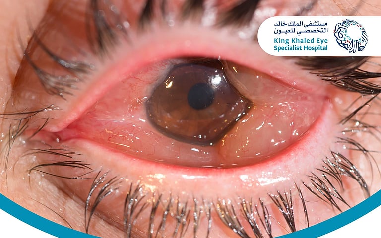 ���� �������� ���� ����� ���� sabq/2025-01-26/