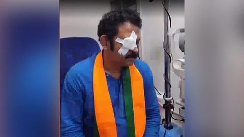 കൃഷ്ണകുമാറിന്റെ കണ്ണിന് പരിക്ക്