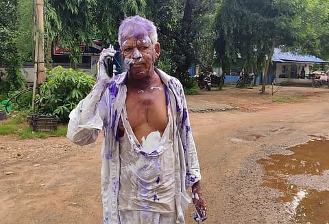खड़गपुर में तृणमूल नेत्री बेबी कोले द्वारा पिटाई किए जाने के बाद थाना पहुंचे अनिल दास
