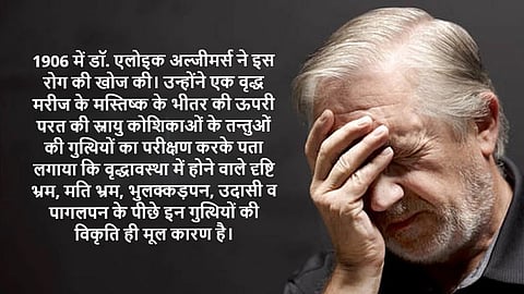 अल्जीमर्स