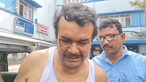 घायल तृणमूल नेता सुभाष घड़ा