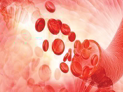 अनीमिया