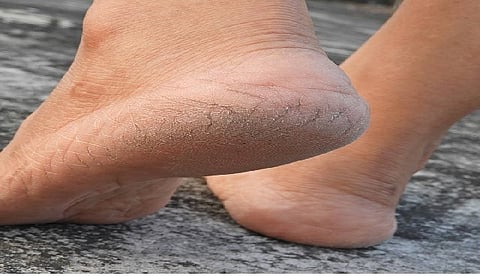 सांकेतिक तस्वीर