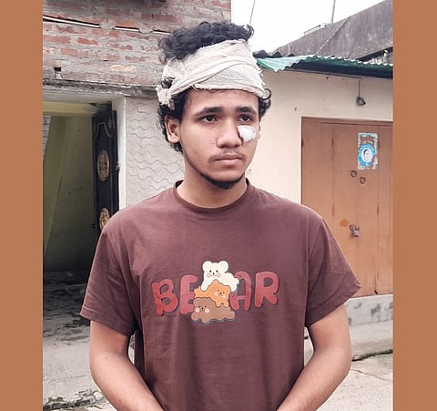 बांग्लादेश में गए बेलघरिया के युवक ने बताई दर्दनाक आपबीती, कैसे दहशत में बिताए दिन