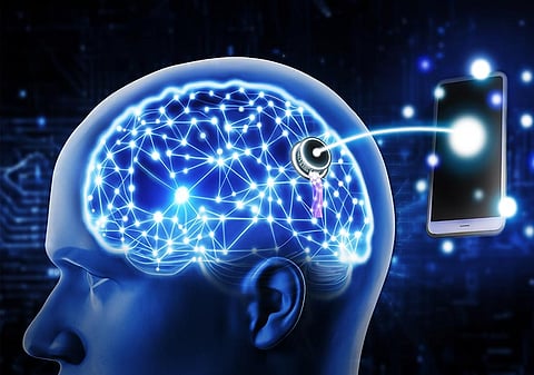 How Brain-Computer Interfaces