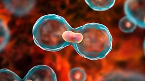Residual cancer 
