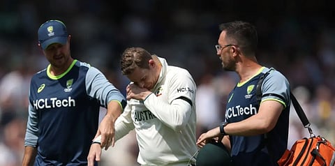 ‘May be able to play with it in a couple of weeks’: Smith reveals plans to return to action after finger injury