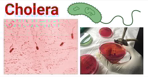 cholera 