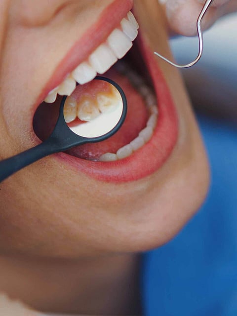 oral problems