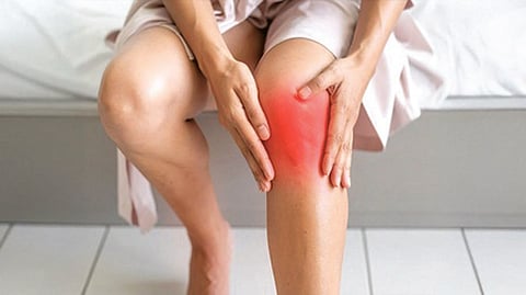 arthritis