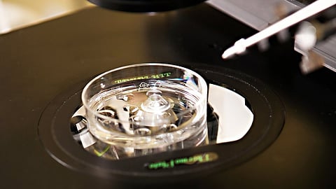 In Vitro Fertilization