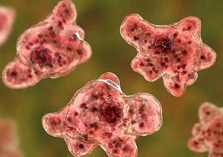 Amoebic Meningoencephalitis