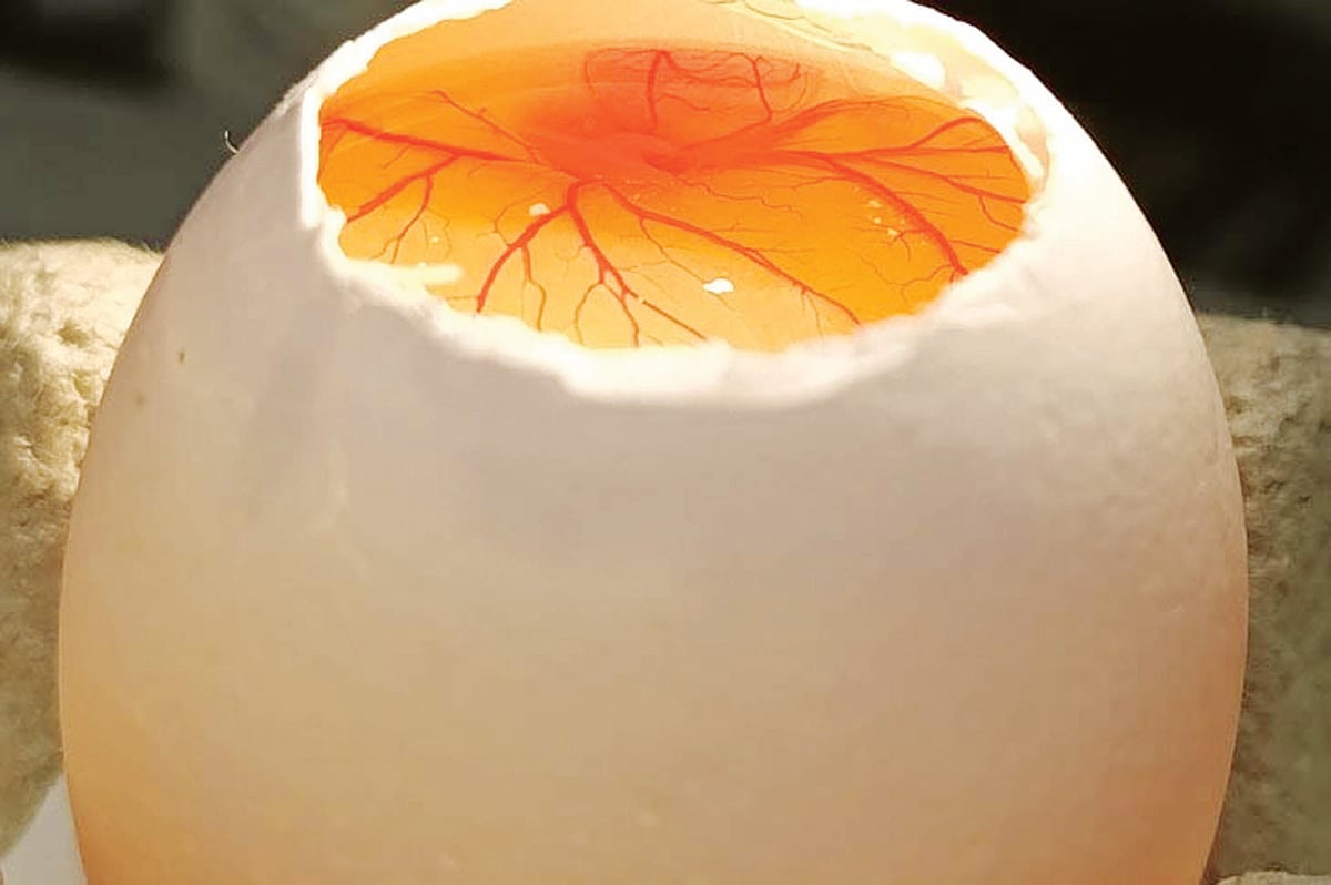 Scientists Build 3D Tumour 'Avatar' to Fight Bone Cancer in Children