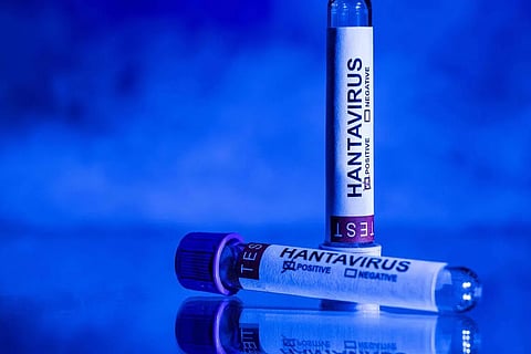 hantavirus 