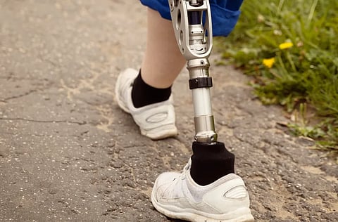  Artificial Leg