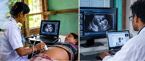 ultrasound 