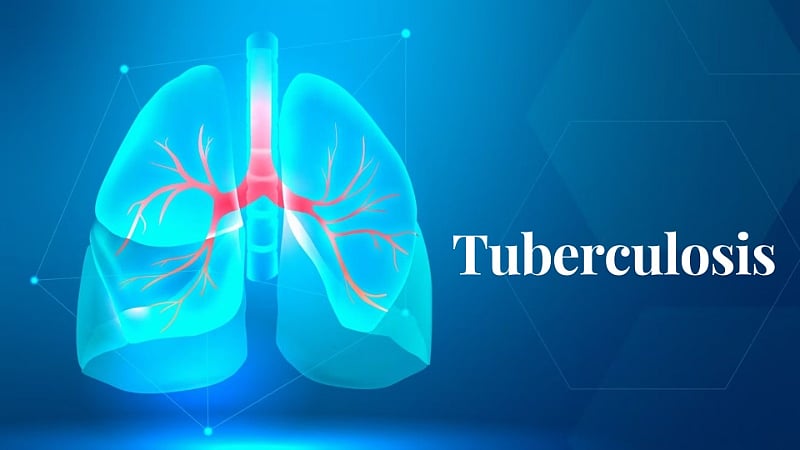 Nikshay Mitra: Support TB Patients with Nutrition