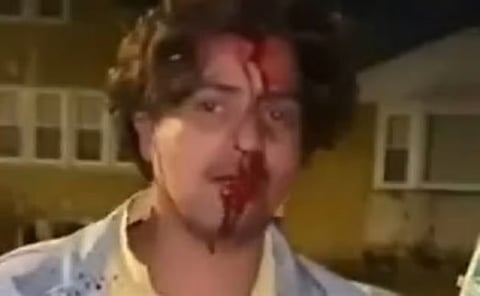 शिकागो में भारतीय छात्र पर हमला
