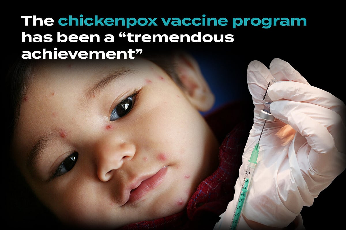 Chickenpox Deaths Have Been “Practically Eliminated” by Vaccines