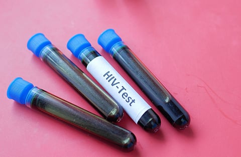 HIV test