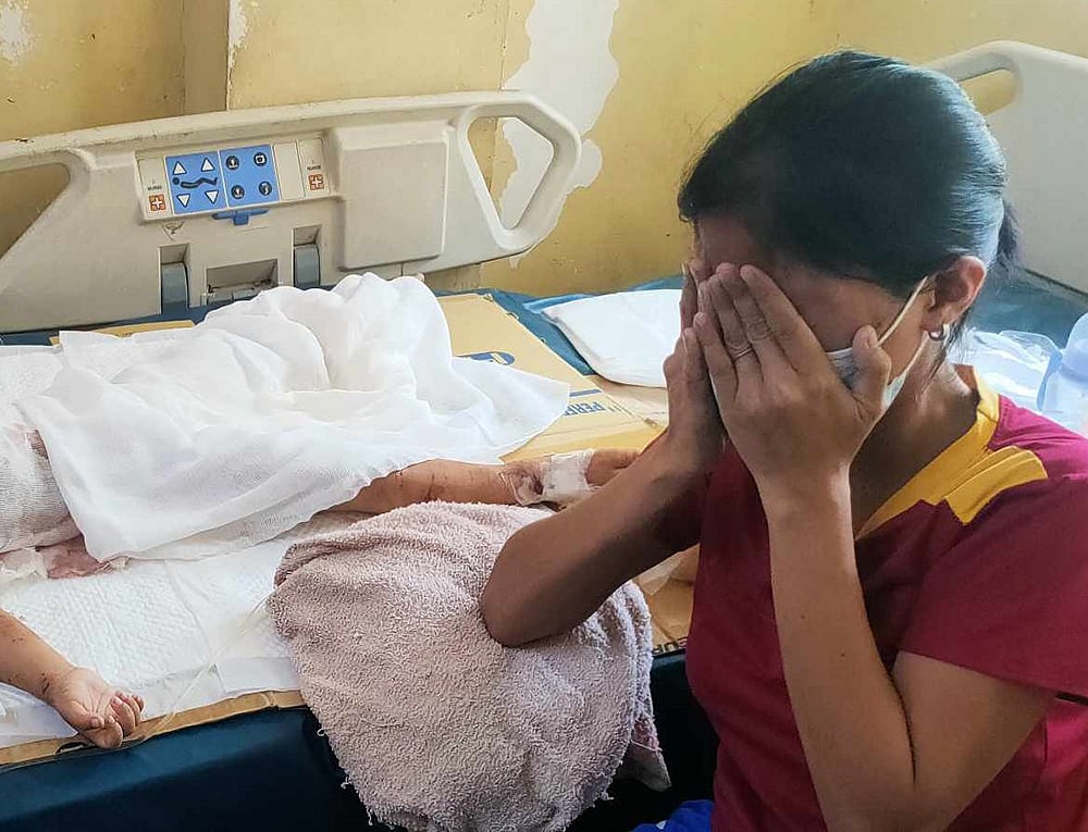 2-year-old child seriously injured after dog attack in Samar - Vimarsana News