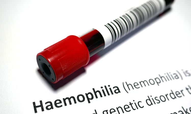 Davao CHO seeks budget boost for Hemophilia treatment - Vimarsana News