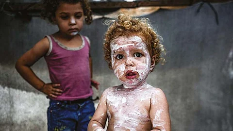 Lice, scabies, rashes plague Palestinian kids